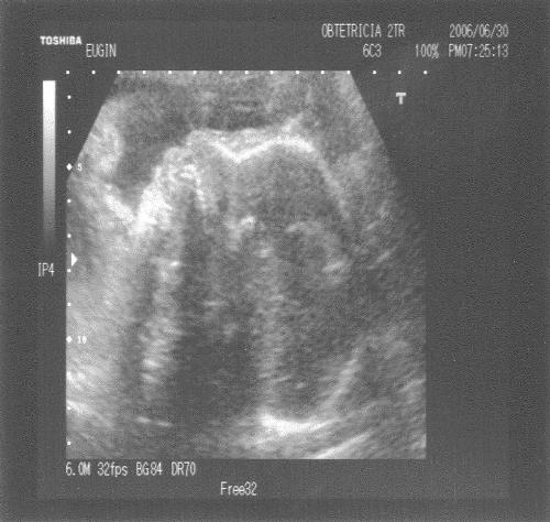 2006-06-30-Eco2.jpg